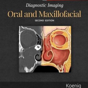Diagnostic Imaging Oral and Maxillofacial by Lisa J. Koenig