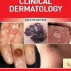 Fitzpatrick's Color Atlas and Synopsis of Clinical Dermatology 8th Edition