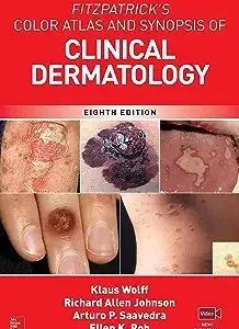 Fitzpatrick's Color Atlas and Synopsis of Clinical Dermatology 8th Edition