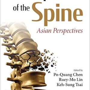 Osteoporosis Of The Spine Asian Perspectives